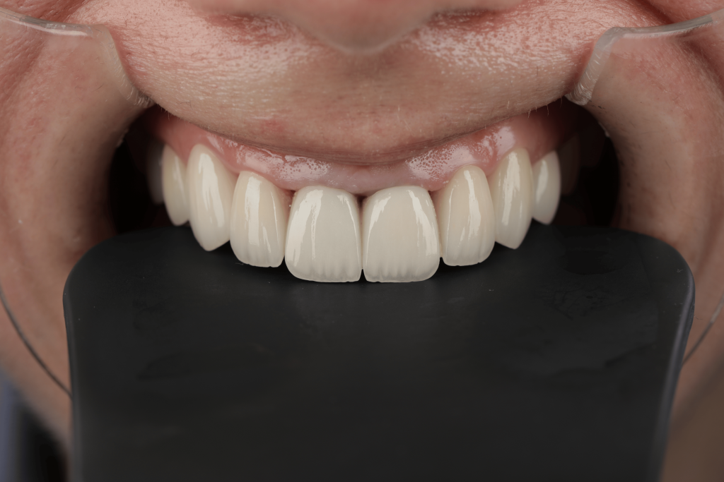 Home Romania Dental Trip