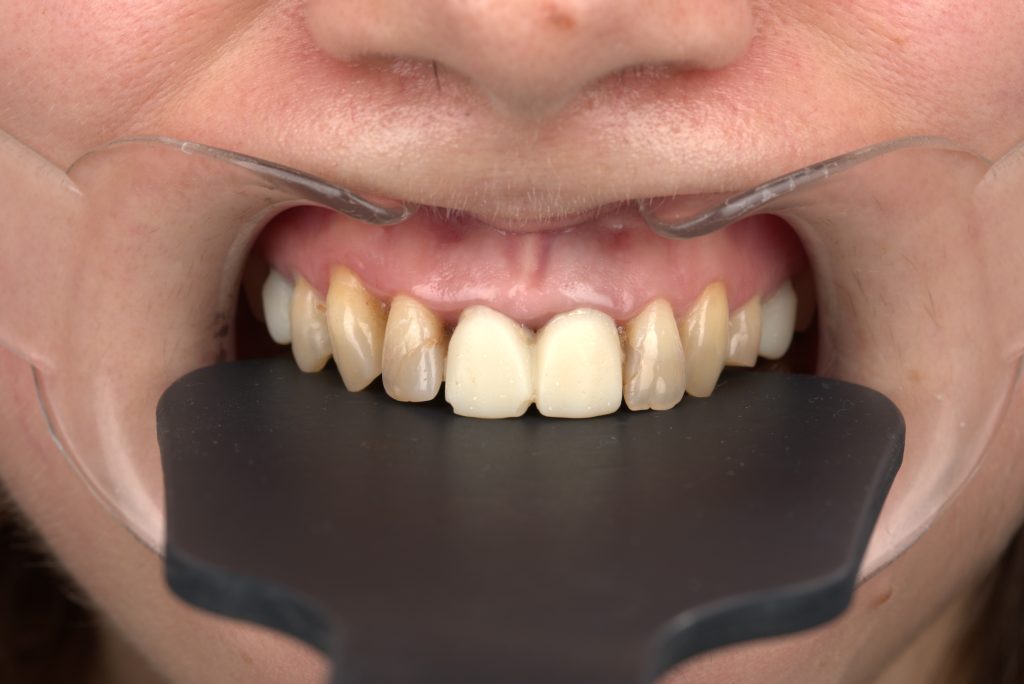 Home Romania Dental Trip