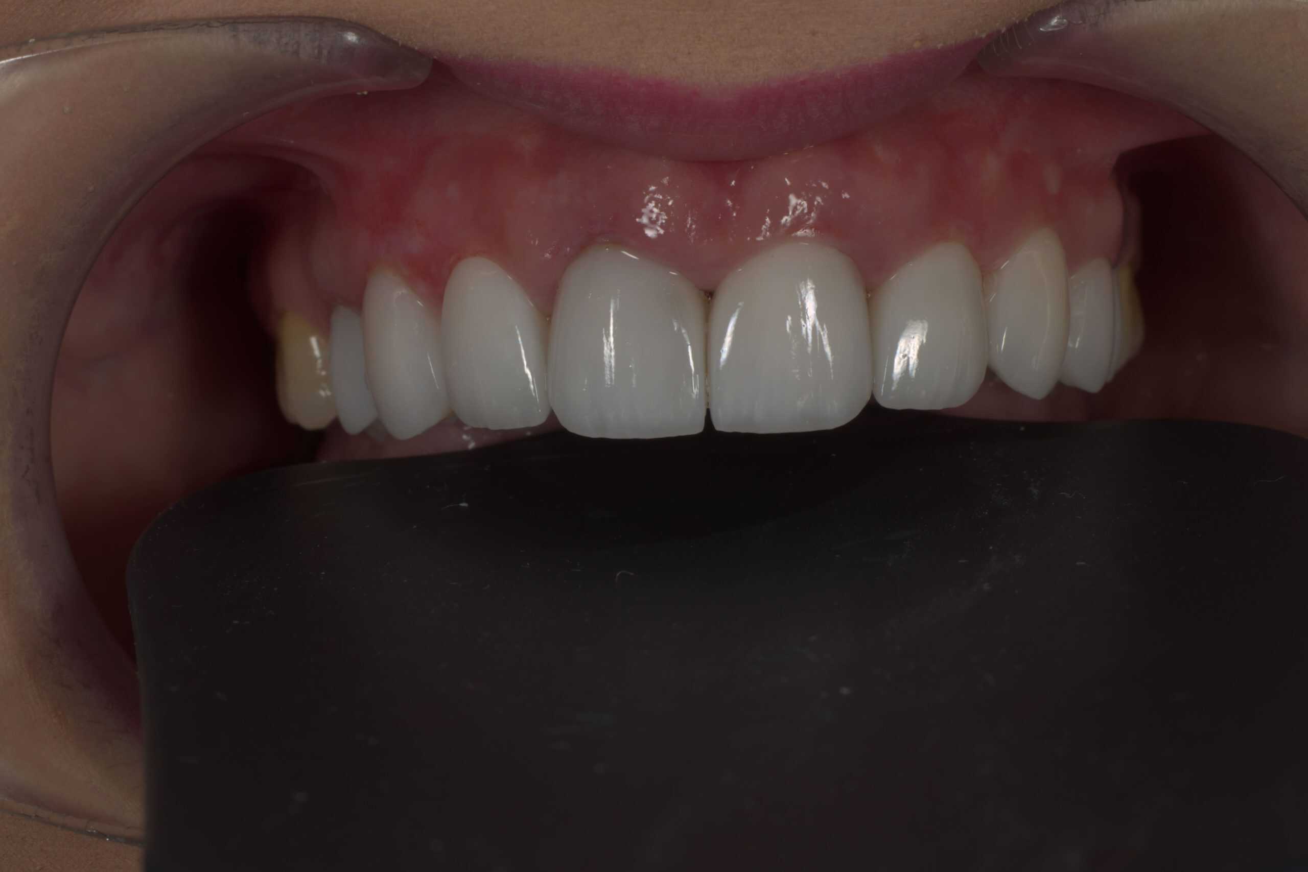 Home romania dental trip